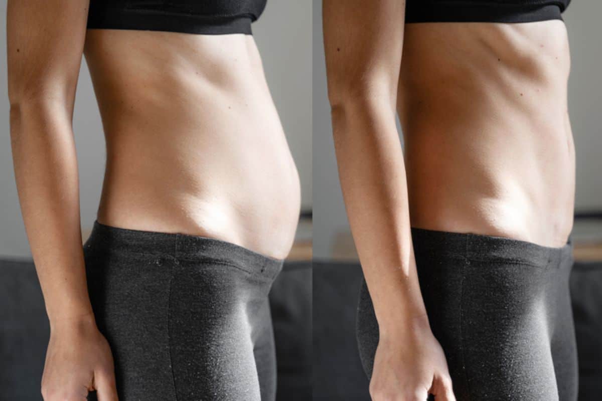 Post-Pregnancy: What Happens to Your Abdominal Muscles After Birth Borehamwood