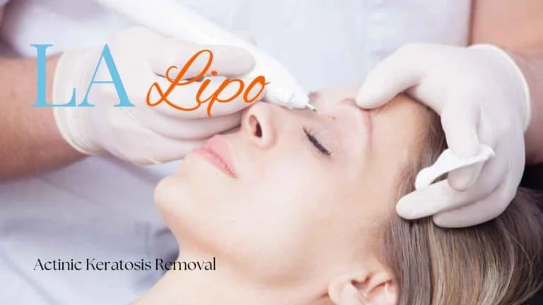 Woman receiving Actinic Keratosis Removal Treatment Borehamwood
