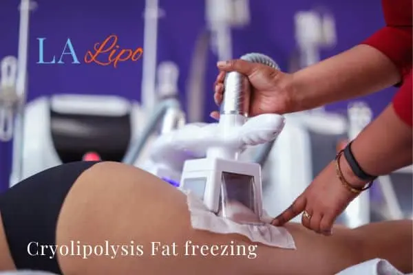 women getting fat freezing Borehamwood