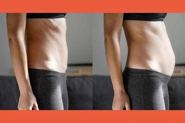 LA-EMS Body Sculpting results Borehamwood