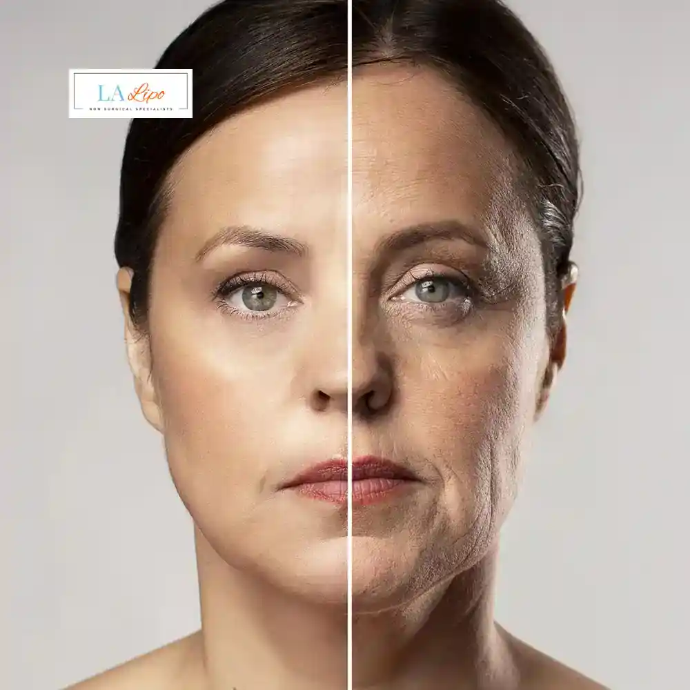 How Can You Tell If Non-Surgical Skin Tightening Is Right for You Borehamwood?
