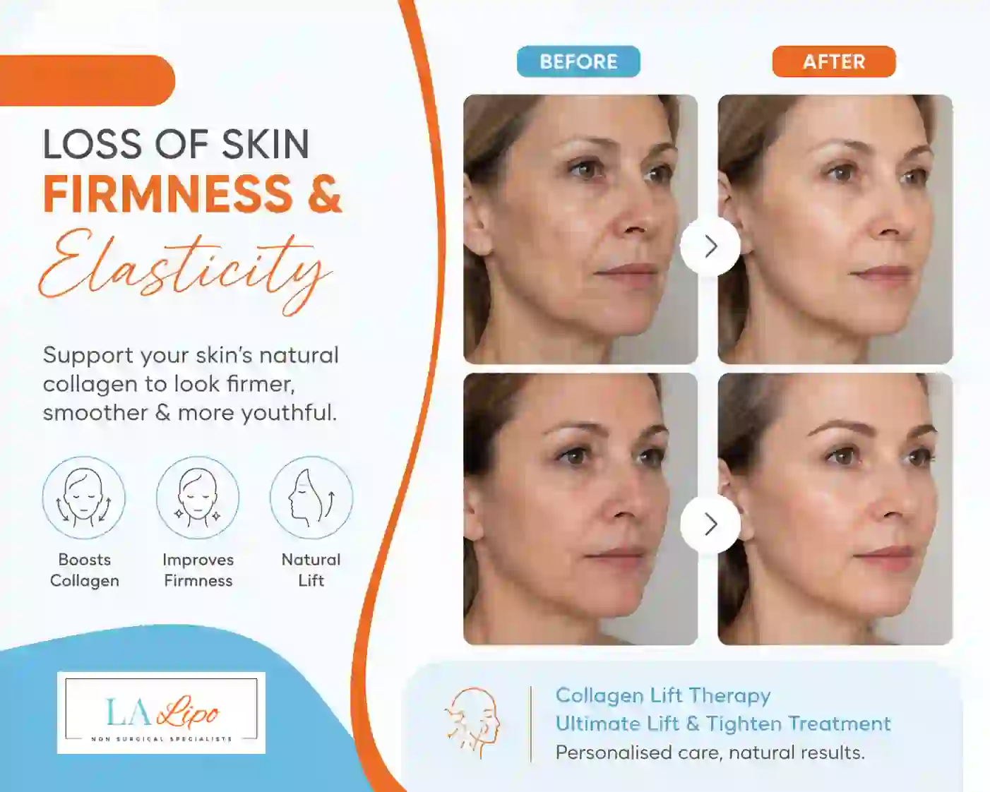 Sign #7: Loss of Skin Firmness and Elasticity Borehamwood